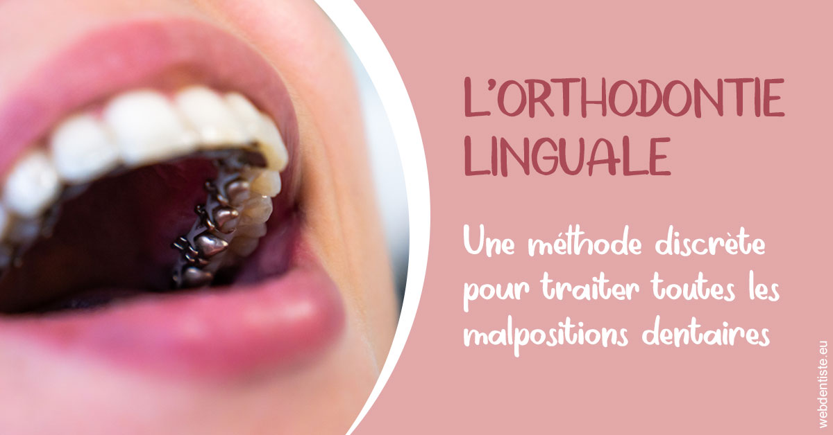 https://selarl-elysees-berri.chirurgiens-dentistes.fr/L'orthodontie linguale 2