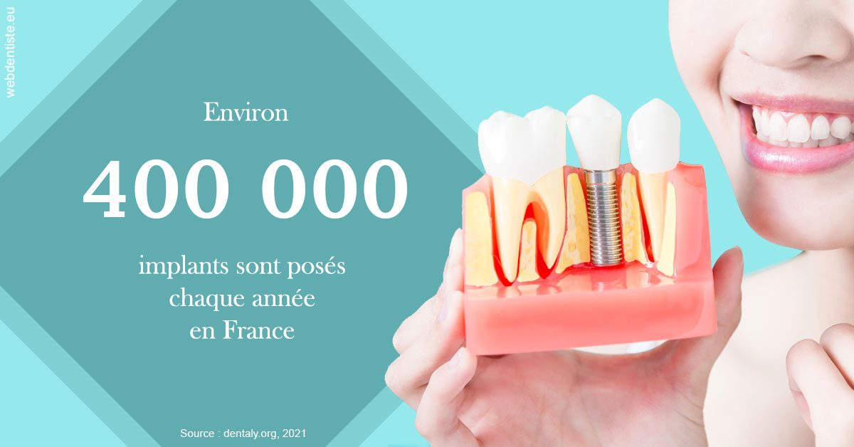https://selarl-elysees-berri.chirurgiens-dentistes.fr/Pose d'implants en France 2